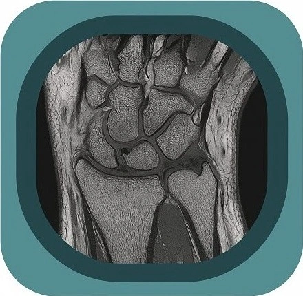MRI wrist anatomy icon